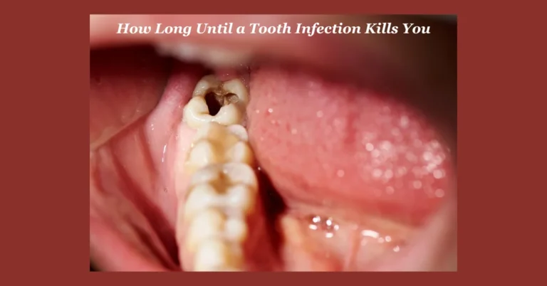 How Long Until a Tooth Infection Kills You? Understanding the Risks and Timelines